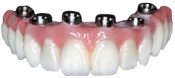 Full Contour BruxZir Solid Zirconia Dental Arch